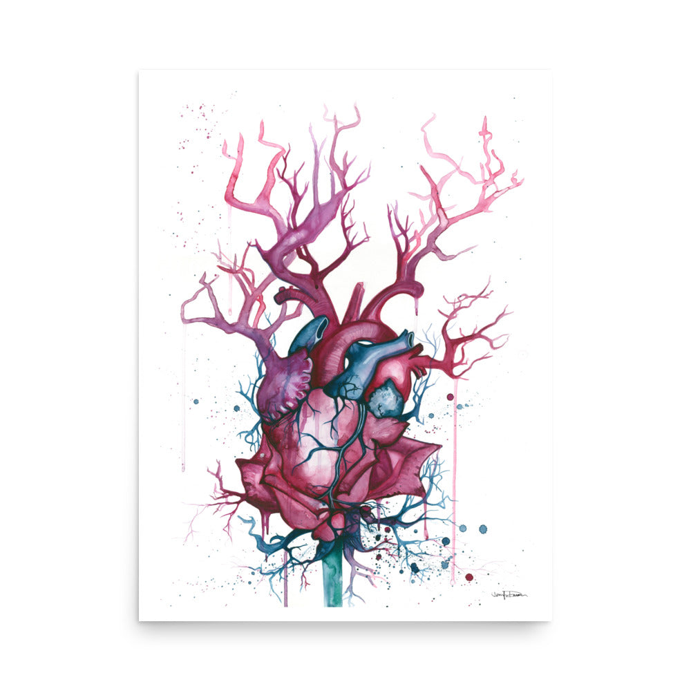 "Sanguine" - Fine Art Print